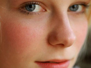 Почему краснеют щеки у подростка