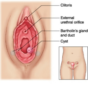 vaginal